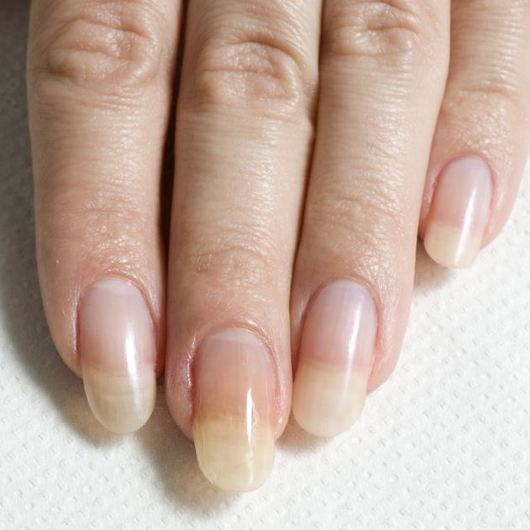 http://www.tlife.gr/files/Image/BEAUTY/2012/HOW_TO_BODY/SPASMENO_NYXIA/resized/12_530_530.jpg
