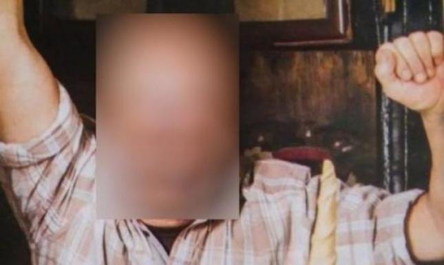 Συγκλονίζει με την περιγραφή του Έλληνας ηθοποιός: Το μισό μου πρόσωπο είχε γίνει πολτός...