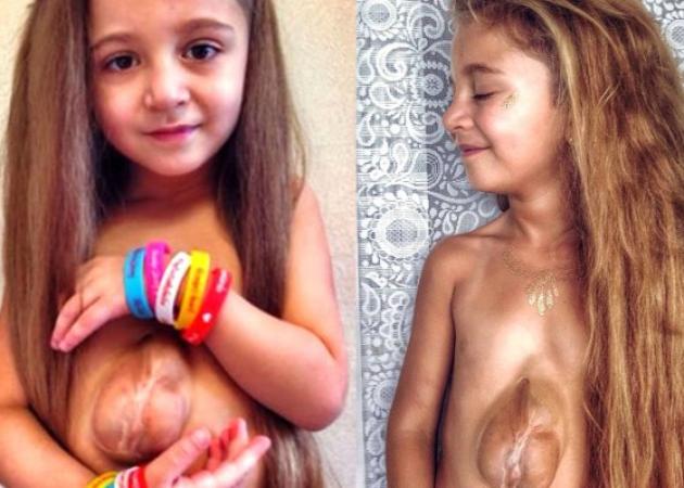 Απίστευτο: 7χρονη γεννήθηκε με την καρδιά έξω από το στέρνο της [vid, pics]