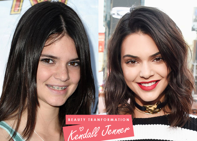 Kendall Jenner: η beauty μεταμόρφωσή της όλα αυτά τα χρόνια!