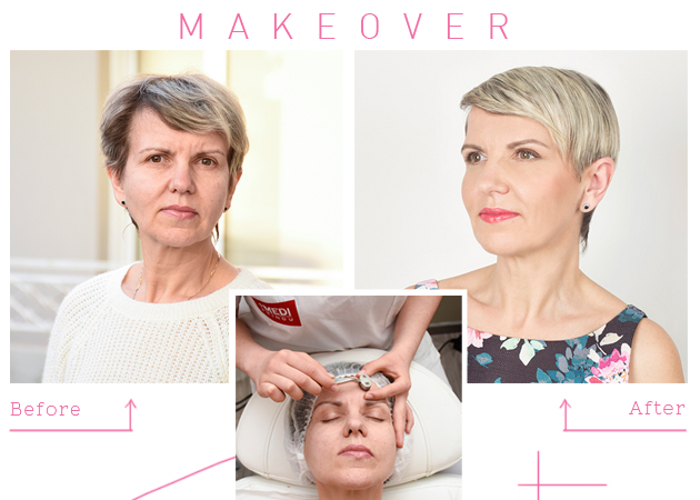 Makeover! Πώς η αναγνώστριά μας εξαφάνισε τις ρυτίδες της και απέκτησε αλαβάστρινη επιδερμίδα