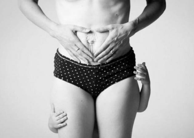Πώς είναι στην πραγματικότητα το γυναικείο σώμα μετά την εγκυμοσύνη; Ένα μοναδικό φωτογραφικό project!