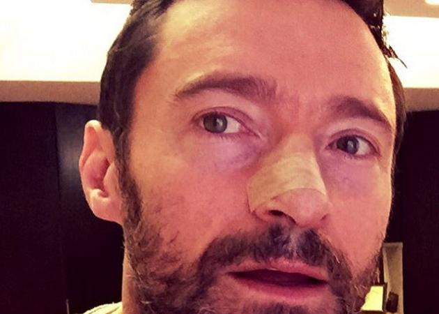 Hugh Jackman: Στα χιόνια μετά την αποκάλυψη για τη νέα περιπέτεια υγείας!