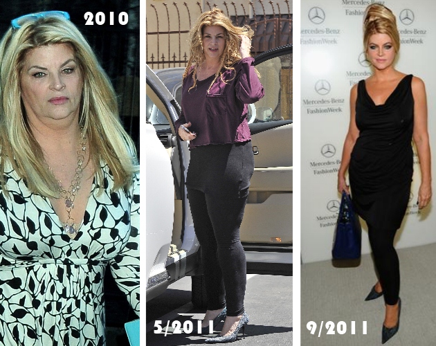 1 | Kirstie Alley