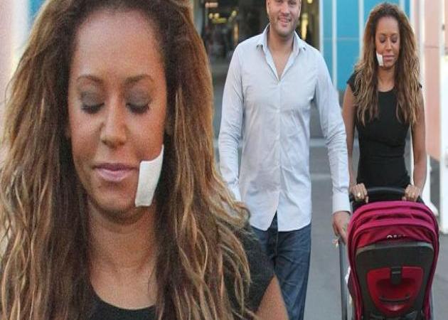 Mel B: Μετά το ξύλο και τα ερωτικά τρίγωνα, φοβάται ότι ο άντρας της θα τη σκοτώσει!