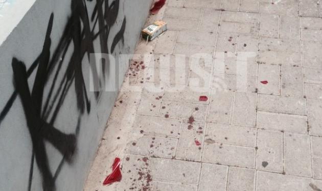Μαθητές μαχαιρώθηκαν έξω από σχολείο του Καματερού
