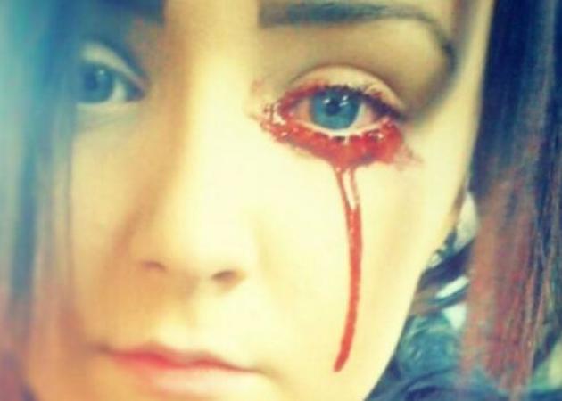 ΣΟΚ με 17χρονη: Τρέχει συνεχώς αίμα από τα μάτια και τα αυτιά της – Άναυδοι οι γιατροί