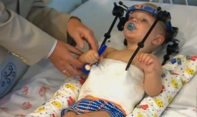Aπίστευτο! Μωρό αποκεφαλίστηκε εσωτερικά και οι γιατροί ένωσαν το κεφάλι με το σώμα του!
