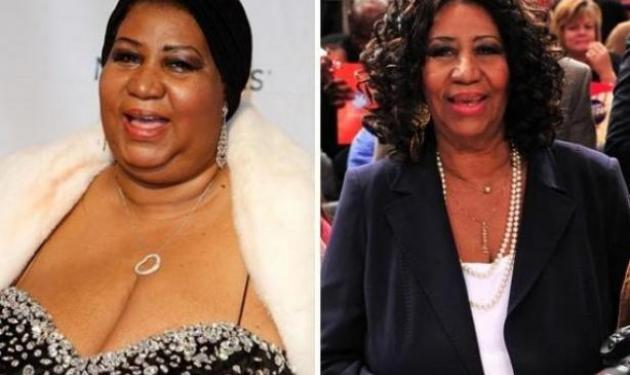 Celebrities που έχασαν κιλά και κέρδισαν… τις εντυπώσεις