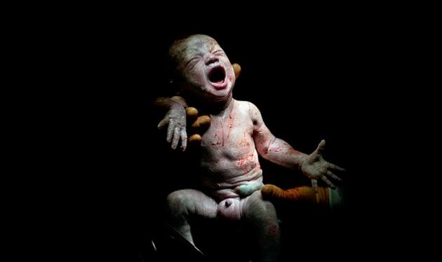 Το θαύμα της ζωής! Συγκλονιστικές φωτογραφίες μωρών που μόλις γεννήθηκαν!