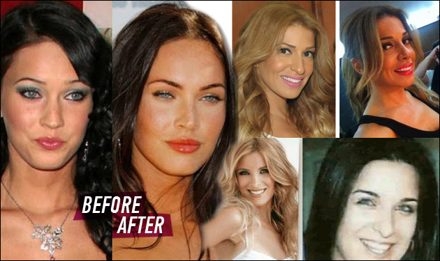Ελληνίδες και ξένες διάσημες πριν και μετά τις πλαστικές! Φωτογραφίες και βίντεο