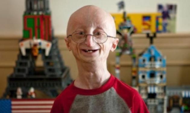 Sam Berns: Πέθανε από γεράματα στα 17 του!