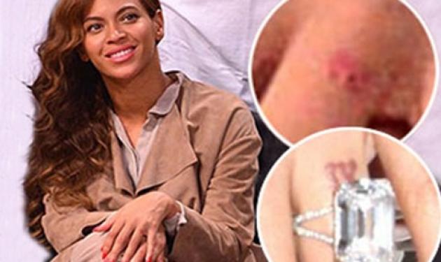 Βeyonce: Η γυναίκα που ήρθε κοντά στον Jay Z και το τατουάζ που έσβησε με την ημερομηνία του γάμου τους!