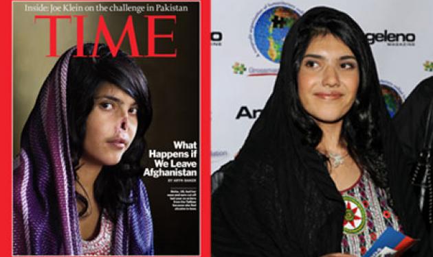 Πήρε το βραβείο World Press για την ακρωτηριασμένη Αφγανή!