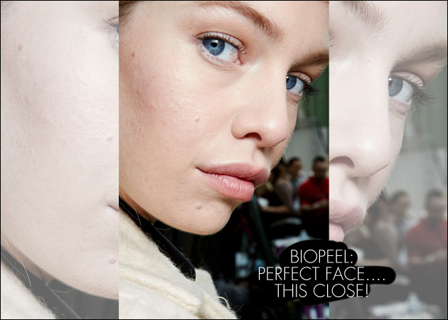 Biopeel: Η θεραπεία που θα σου δώσει αψεγάδιαστη επιδερμίδα… όσο κοντά κι αν έρθει κανείς!