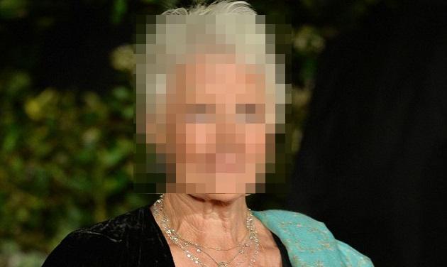 Ποια διάσημη ηθοποιός αποκάλυψε ότι έχει σχεδόν χάσει την όραση της;