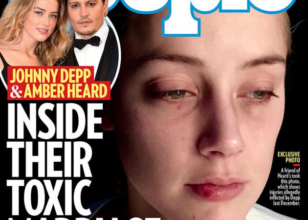 Σοκάρουν οι νέες φωτογραφίες της κακοποιημένης Amber Heard – Με μώλωπες η πρώην του Johnny Depp