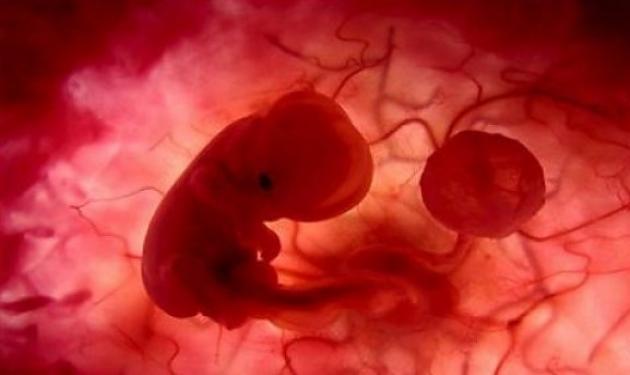 Συγκλονιστικό: Μητέρα απέβαλε το έμβρυο που κυοφορούσε μέσα στην τουαλέτα