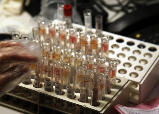 Σπουδαία ανακάλυψη Ελλήνων ερευνητών για τα κύτταρα