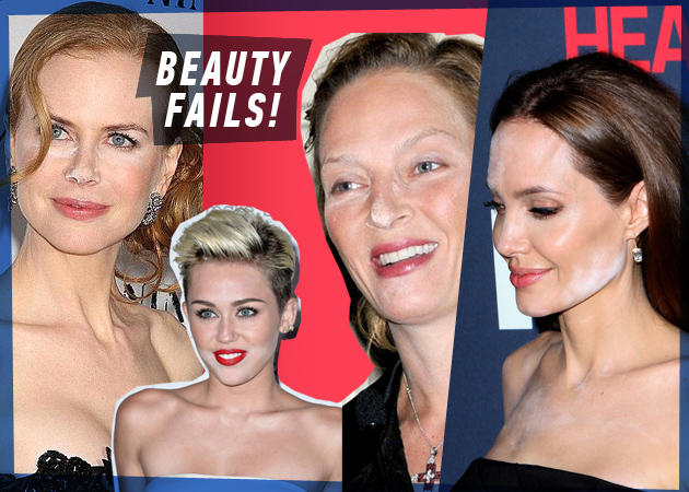 Beauty ατυχήματα! Ξέρουμε τι συνέβη στην Angelina Jolie και τις άλλες stars!