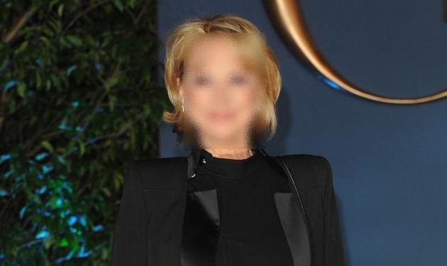 Διάσημη ηθοποιός σταμάτησε το botox για έναν χρόνο και η εικόνα της άλλαξε πολύ!