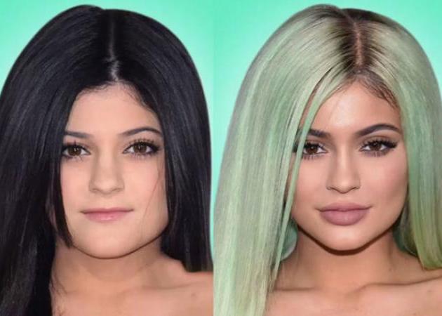 Όλες οι πλαστικές που έχουν κάνει οι Kardashian- Jenner στο πρόσωπό τους σε ένα βίντεο!