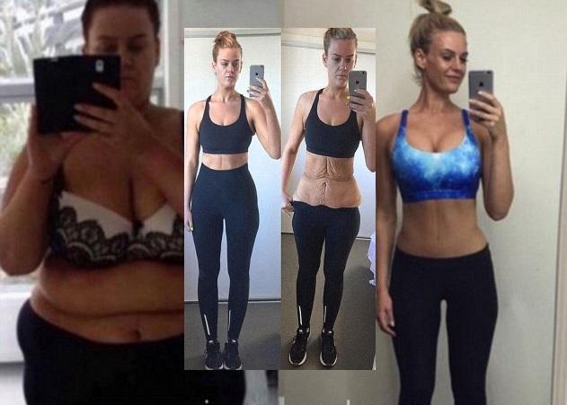 Έχασε 92 κιλά και έδειξε την μεταμόρφωσή της στο instagram! Σοκαριστικές φωτογραφίες