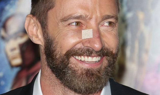Hugh Jackman: Τον χτύπησε ξανά ο καρκίνος του δέρματος