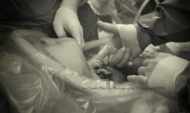 Η συγκινητική φωτογραφία που κάνει το γύρο του κόσμου!Η “χειραψία” βρέφους με τον γιατρό την ώρα της γέννας!
