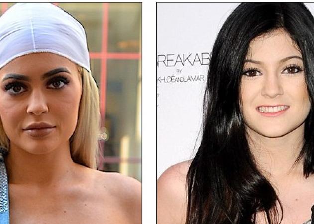 Kylie Jenner: Την κατηγορούν ότι έχει κάνει πλαστικές και πλέον είναι …μια άλλη![pics]