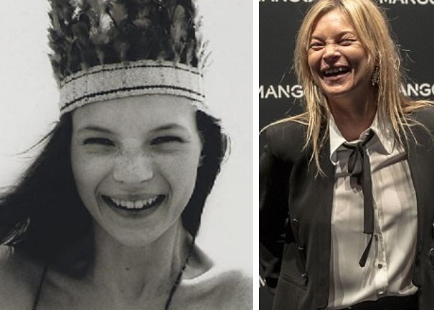 Kate Moss: δες την απίστευτη μεταμόρφωσή της τα τελευταία 20 χρόνια!