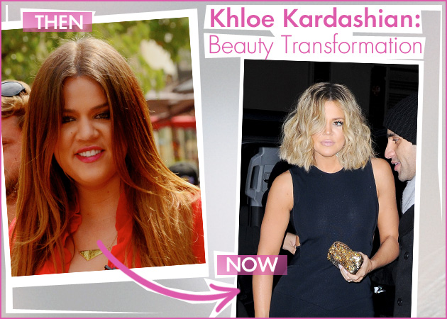 Khloe Kardashian: η απίστευτη beauty μεταμόρφωσή της σε 20 φωτογραφίες!