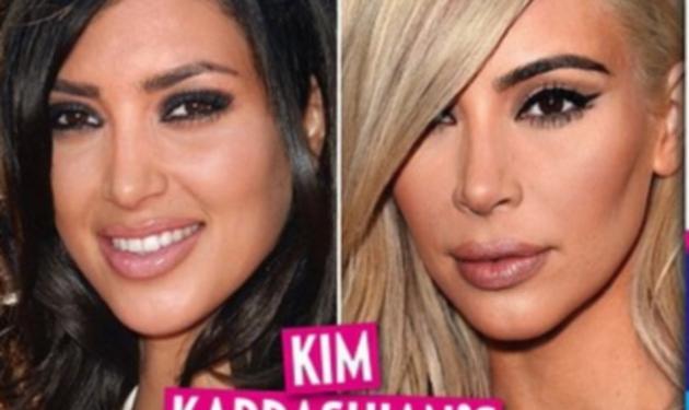Κim Kardashian: Την κατηγορούν ότι κάνει συνέχεια ενέσεις στο πρόσωπό της για να μένει νέα!