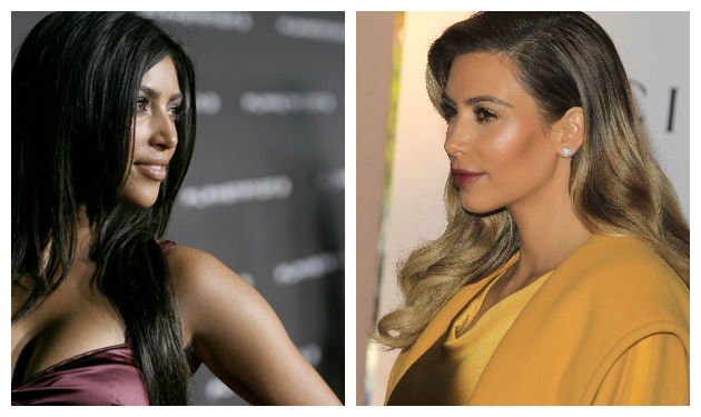Kim Kardashian: Οι…  αλλαγές στη μύτη της, παρά τους ισχυρισμούς της ότι δεν έχει κάνει πλαστική!