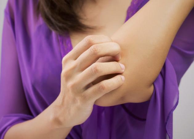 Το κόλπο πριν βγεις έξω για να μην σε τσιμπάνε τα κουνούπια