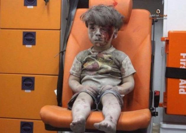 Το βλέμμα του μικρού παιδιού που μας στοιχειώνει όλους! Ο μικρός Ομράν από την Συρία