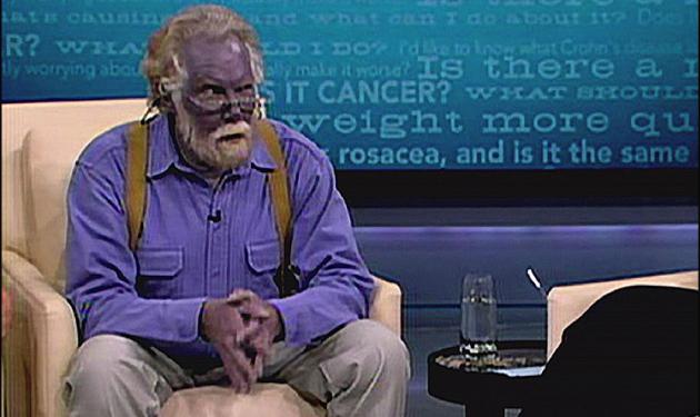 Πέθανε στα 62 χρόνια του ο άντρας με το μπλε δέρμα