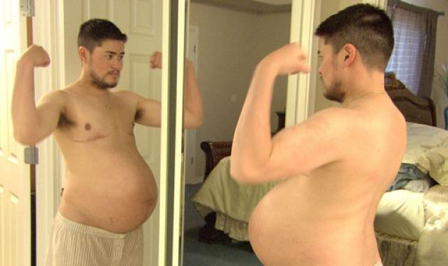 Ο άντρας που έχασε τα κιλά… της εγκυμοσύνης του! Δες φωτογραφίες
