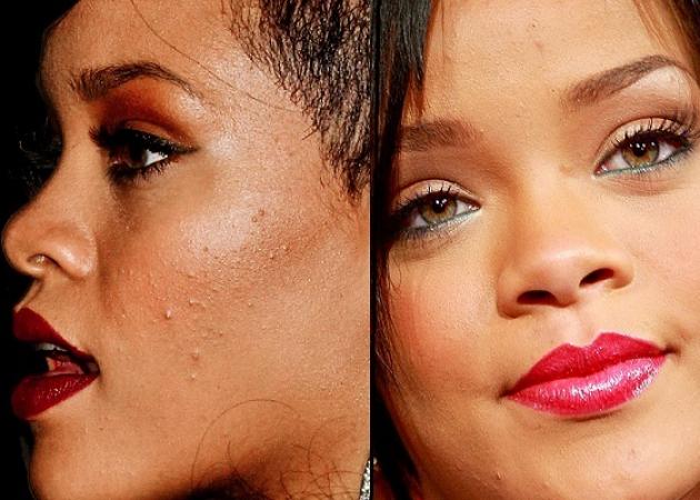 2 | Rihanna