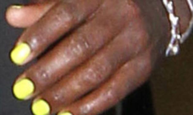 Γνωστός τραγουδιστής, που χώρισε πρόσφατα, έβαψε κίτρινα τα νύχια του! Ποιος είναι;