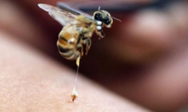 Σε τσίμπησε σφήκα ή μέλισσα; Δες τι πρέπει να κάνεις!