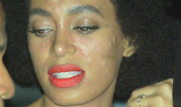 Solange Knowles: Σοκαριστική φωτογραφία με τα εξανθήματα που πέταξε την ημέρα του γάμου της!