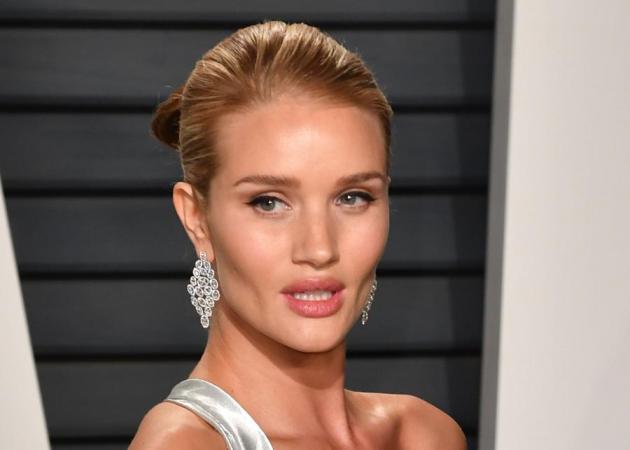 H τραγική beauty εμπειρία της Rosie Huntington- Whiteley! Μπορεί να έχει συμβεί και σε ΄σένα!