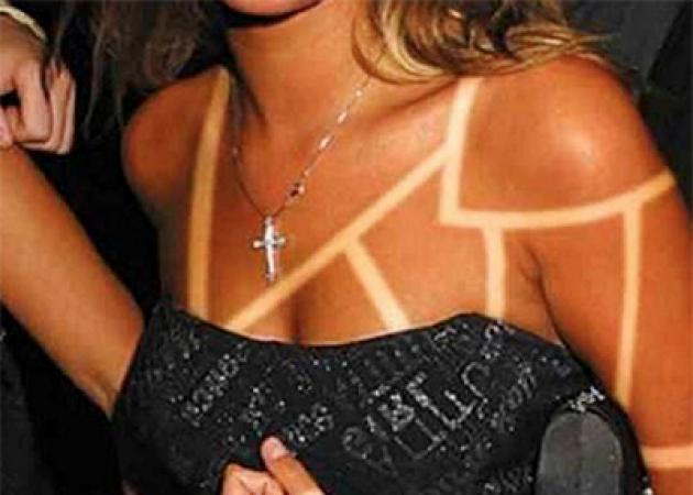 #sunburnart: το πιο επικίνδυνο (και άκυρο!) beauty trend στα social! Τι είναι!