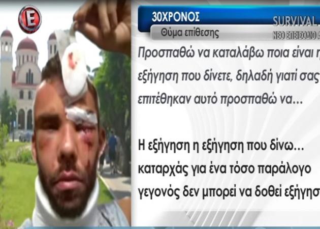 Θύμα άγριου ξυλοδαρμού καταγγέλλει ότι έπεσε 30χρονος στο Ρέθυμνο – Τι λέει ο ίδιος στην Tatiana Live