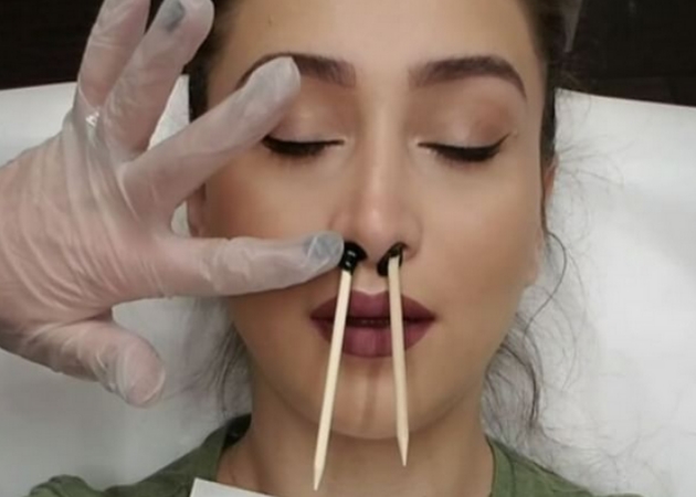 Αυτό το βίντεο με την αποτρίχωση στη μύτη έγινε viral και το internet έχει κάποιες σοβαρές ερωτήσεις
