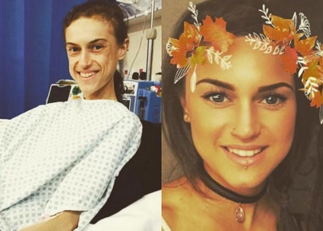 Συγκλονιστικές εικόνες! Νίκησε τον εφιάλτη της ανορεξίας – Πώς είναι σήμερα