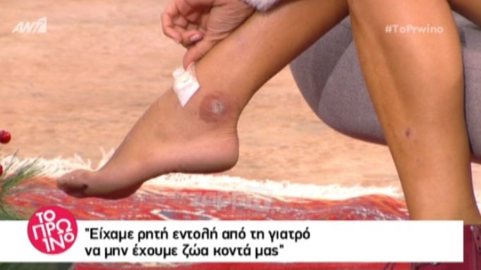 Σοκάρει η Αποστολία Ζώη: Μολύνθηκε από σταφυλόκοκκο!