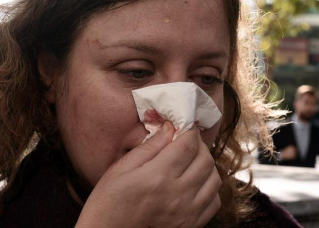 Σοκάρει η περιγραφή της δικηγόρου που ξυλοκοπήθηκε από χρυσαυγίτες: «Ετρεξε και μου έριξε μπουνιά» [pics, vid]