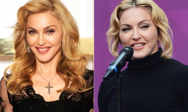 Madonna: Μήπως… “πρήστηκε” πολύ; Οι αντιδράσεις των θαυμαστών της